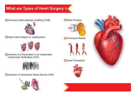 Types of heart surgery | PPT