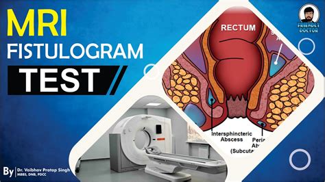 MRI Fistulogram Test Anal Fistula MRI Test YouTube