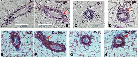 Dlc1gt Mice Show Increased Stromal Collagen Deposition In Mammary Download Scientific Diagram