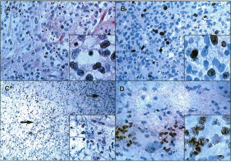 Hematoxylin And Eosin Staining And Immunohistochemistry For The