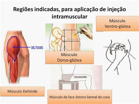 Administração De Medicamentos Por Via Intramuscular tutorial