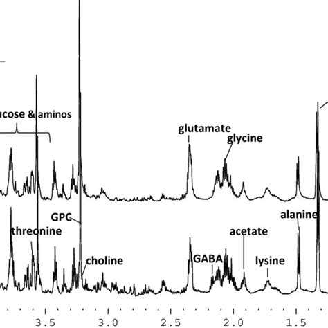 Typical ¹h Nmr 1d Cpmg Spectra Of Metabolites In Cytoplasm A Control Download Scientific