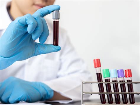 Exame De Sangue Como Entender Os Resultados Labvw Análises