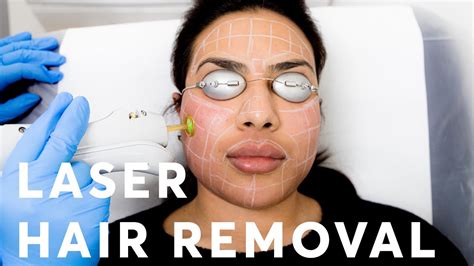 Laser Hair Removal Indian Skin Types Youtube