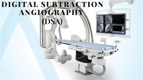 Digital Subtraction Angiography Dsa Youtube