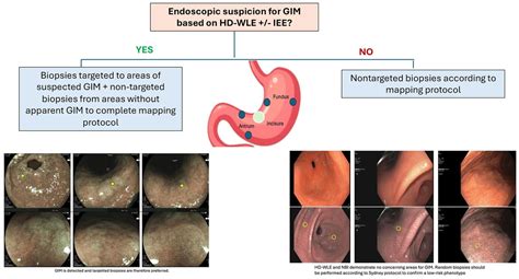 The Road To A World Unified Approach To The Management Of Patients With