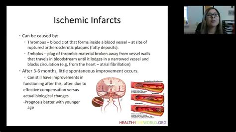 Neuroanatomy And Functional Sequelae Of Stroke Part 1 Health4theworld Academy Youtube