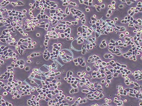 Mda Mb 453细胞人乳腺癌细胞 逸漠细胞库