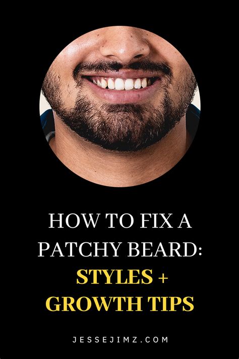 How To Fix A Patchy Beard Styles Growth Tips Artofit