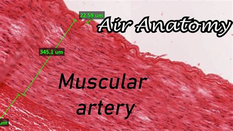 Muscular Artery Vs Elastic Artery Histology