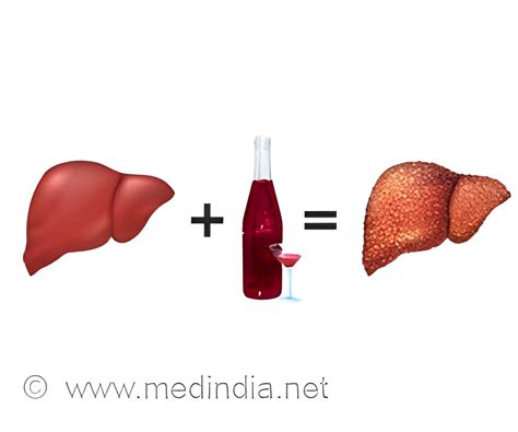 Non Alcoholic Fatty Liver Disease Risk Factor For Liver Cancer