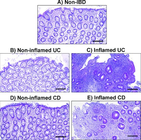 Representative Histological Sections Stained With Hematoxylin And Eosin