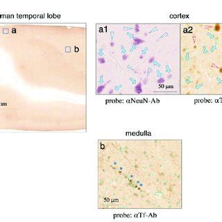 Sds Page And Immunoblotting Of Human Brain Extracts Brain Extracts