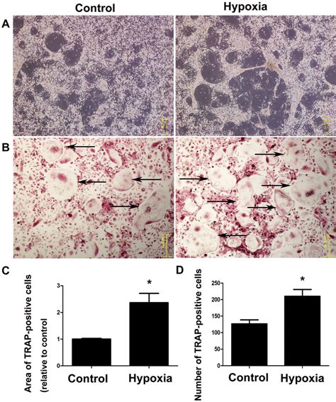 Hypoxia Promoted Pglps—and Rankl Induced Osteoclast Differentiation In Download Scientific