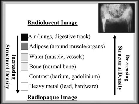 Introduction To Msk Imaging Flashcards Quizlet