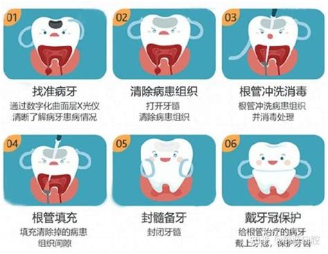 蛀牙可以自己自愈吗？不可以哦！ 知乎