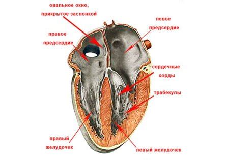 Ложная хорда левого желудочка сердца: как действовать