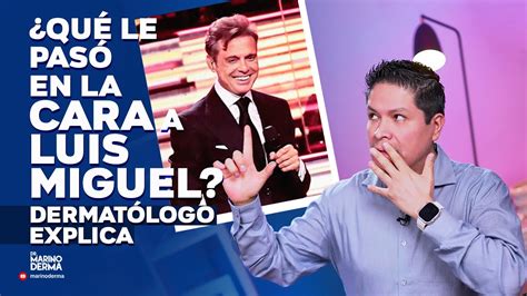 QUÉ LE PASÓ EN LA CARA A LUIS MIGUEL DERMATÓLOGO EXPLICA YouTube