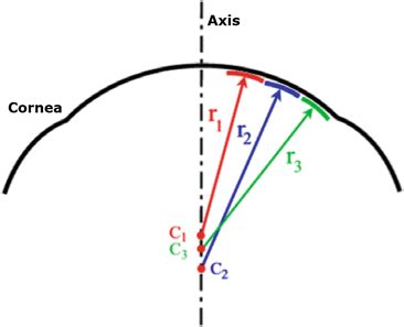 Diagnostic Approach of Corneal Topography Maps | Ento Key