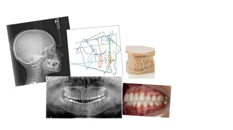 Documenta Es Ortod Nticas Cadi Centro Avan Ado De Diagn Stico Por