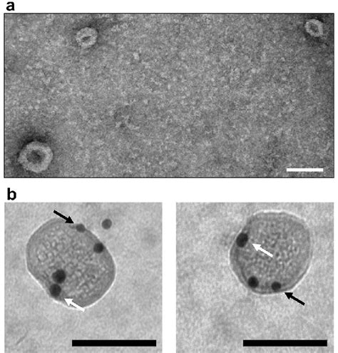 Electron Micrographs Of Extracellular Vesicles From Astrocyte Cultures