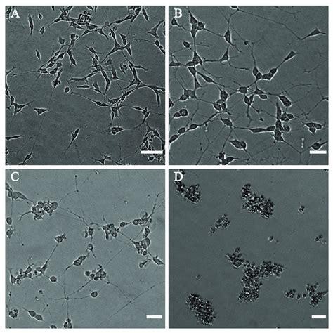 Phase Contrast Microscope Images Of Differentiated Sh Sy Y After