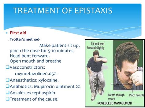 Epistaxis