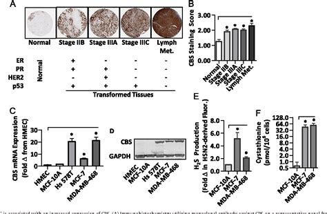 Figure 1 From Role Of Cystathionine β Synthase In Human Breast Cancer