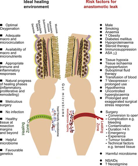 Anaesthesia And Intestinal Anastomosis Bja Education