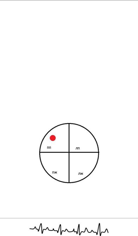 ЭКГ