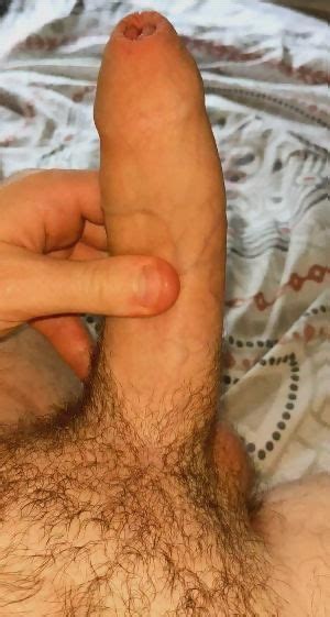 26 Pulling Back My Foreskin Nice And Slowly Reddit NSFW