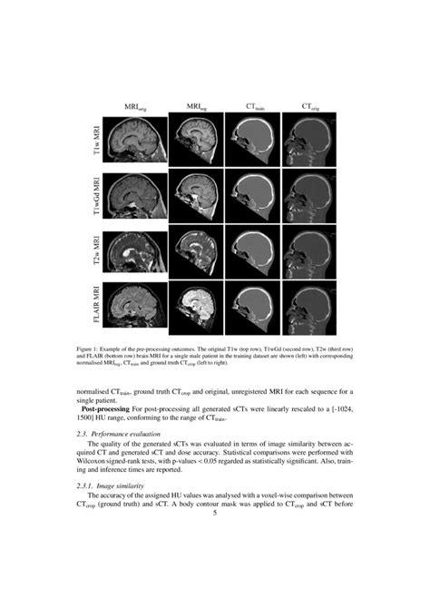 Exploring Contrast Generalisation In Deep Learning Based Brain Mri To