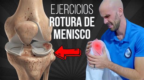 Rutina De EJECICIOS Para ROTURA DE MENISCO FASE 1 YouTube