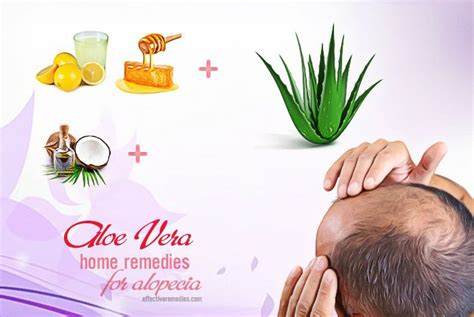 30 Ancient Proven Natural Home Remedies For Alopecia Areata