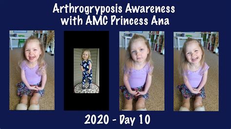 2020 Arthrogryposis Awareness With Amc Princess Ana Day 10 Youtube