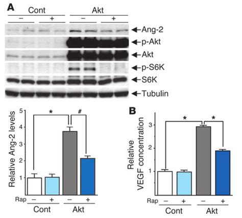 Induction Of Vegf A And Ang By Akt In Cultured Adult Cardiac