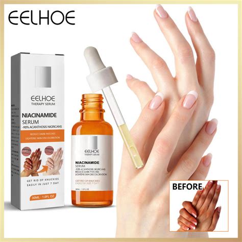 Eelhoe Niacinamide Serum Dark Knuckles Whitening Serum Pigmentation