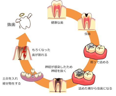 一般治療 虫歯・歯周病治療 つくば市の歯医者つくば中央歯科