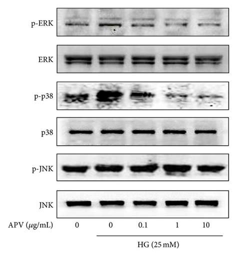 A Effect Of Apv On High Glucose Induced Nf Kappab Activation The