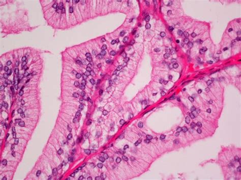 Vector Laboratories Hematoxylin and Eosin Stain Kit, Quantity: Each of | Fisher Scientific