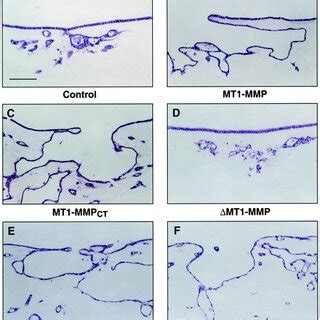 Invasion Of Peritoneal Tissue By MDCK Transfectants In Vivo A Vector