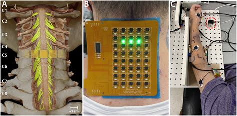 Frontiers Targeted Transcutaneous Spinal Cord Stimulation Promotes