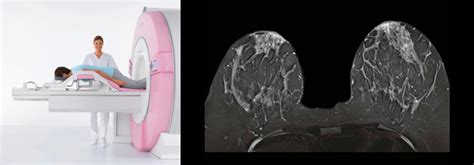 Breast Mri Zwanger Pesiri Radiology