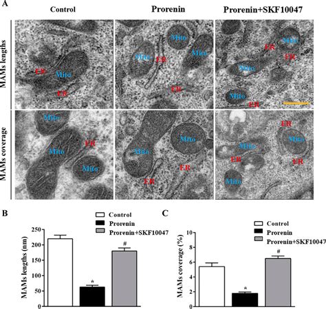 Immune transmission electron microscopy showed that activation of σ 1R