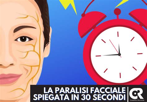 La Paralisi Facciale Di Bell Spiegata In Secondi