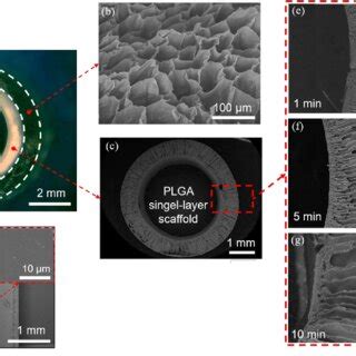 Cross Sectional Morphology Of Dual Layer Scaffolds A Microscopic