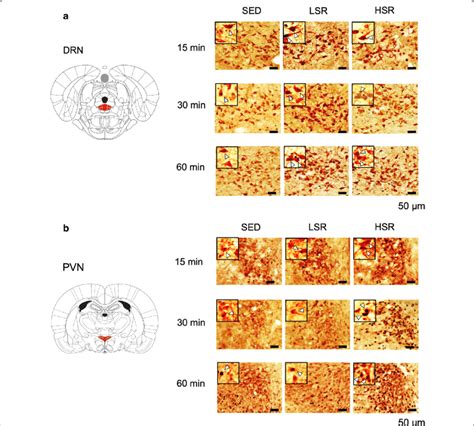 Photographs Of Double Staining For C Fos And Serotonin 5 Ht In The