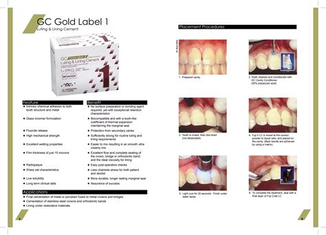 Gc Gold Label Posterior Restorative Gc India Dental Ppt