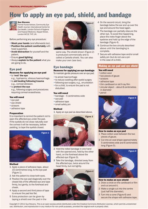 Pdf How To Apply An Eye Pad Shield And Bandage