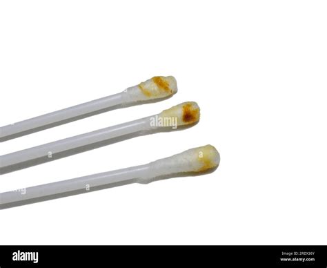 Dirty Cotton Swabs Earwax On Cotton Swabs Personal Hygiene Dirt From